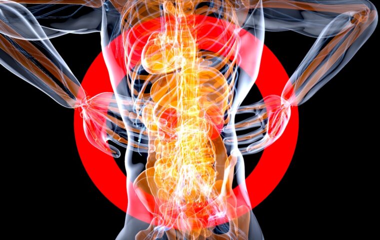 How to Prevent the Everyday Back Pain That Creeps Up